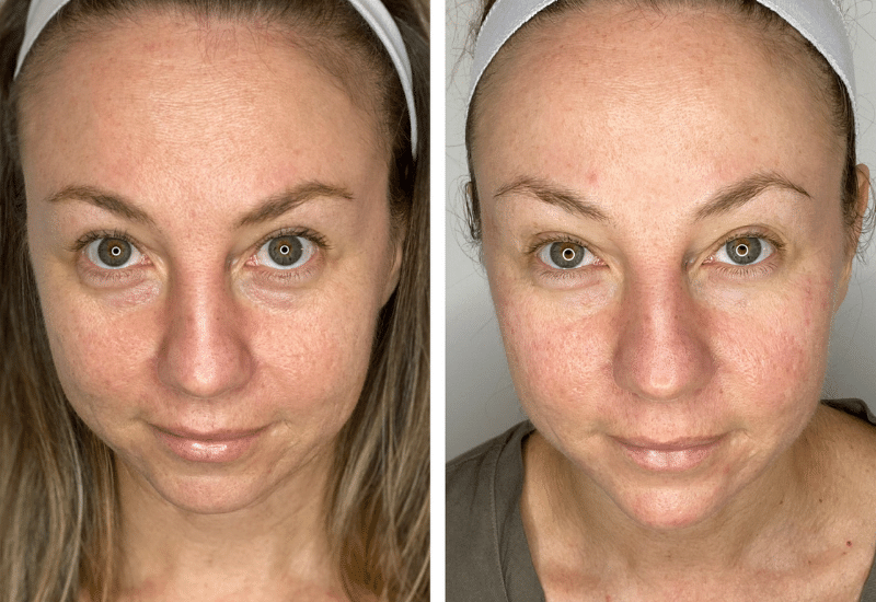 Client-1--Before-After-2B
