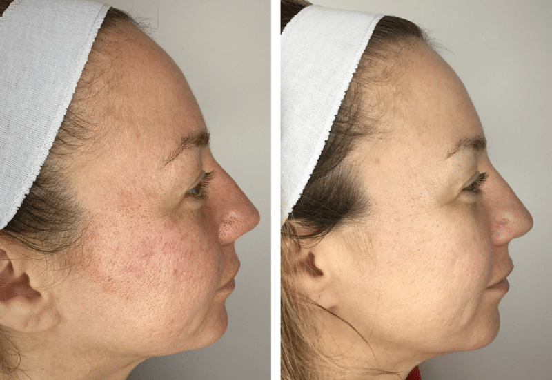Client-1--Before-After-1B