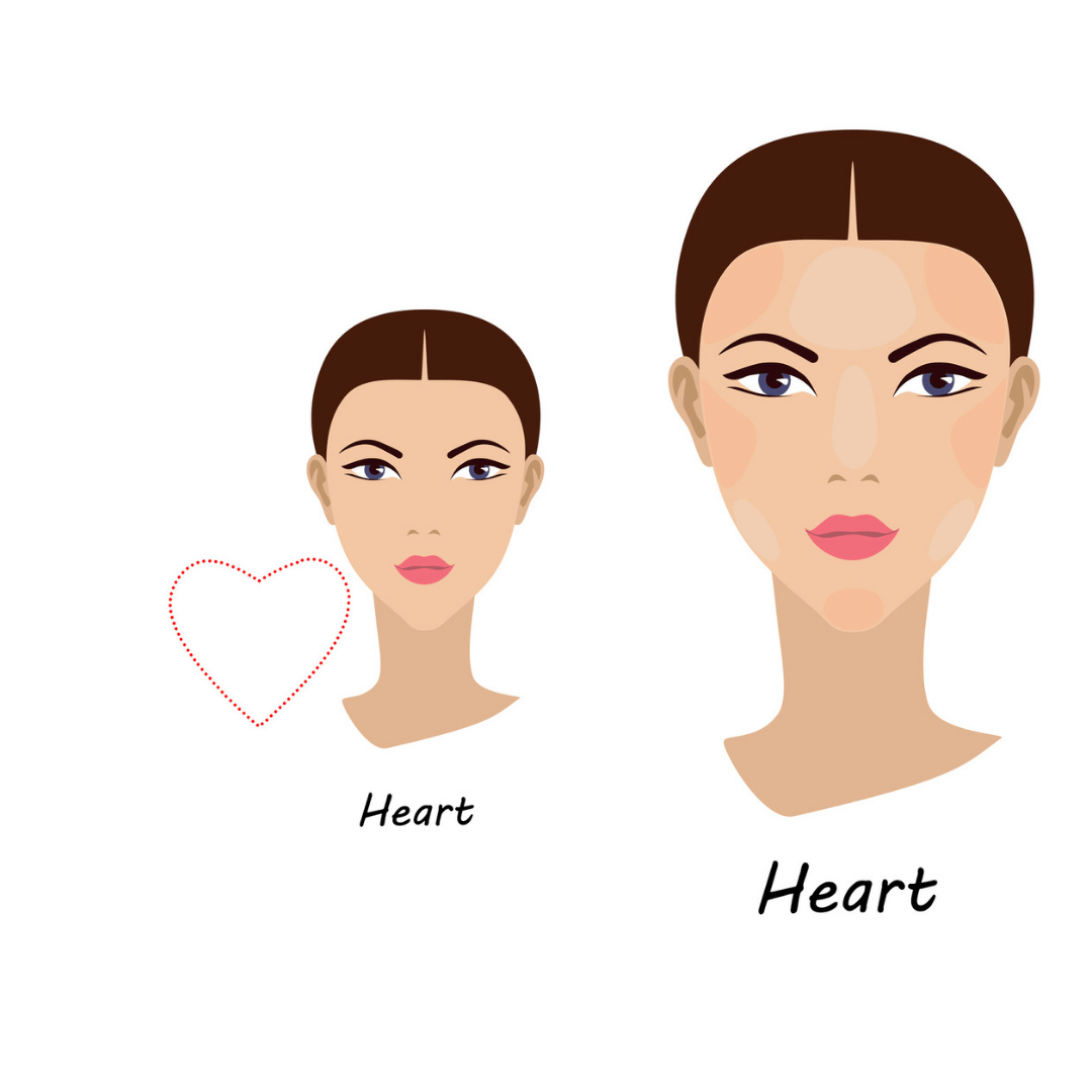 heart shaped face and dermal filler application areas