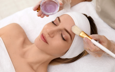 Radiant Skin: Why Chemical Peels Are Good