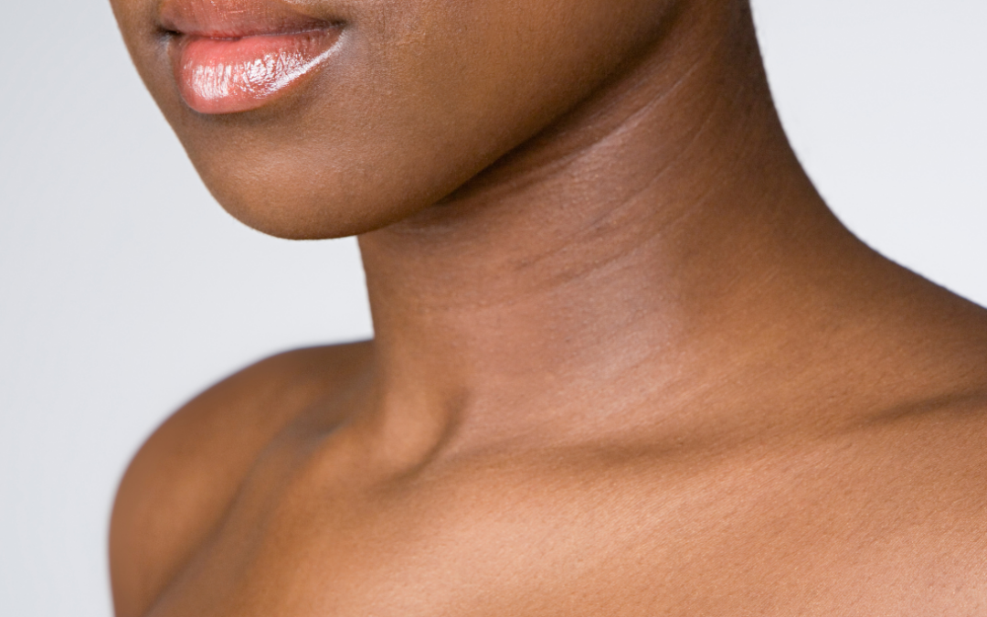 Sculptra for the Neck