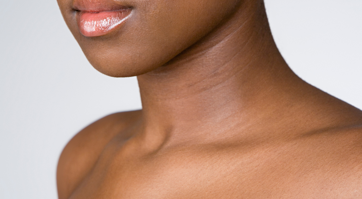 Header image of a beautiful neck treated with Sculptra